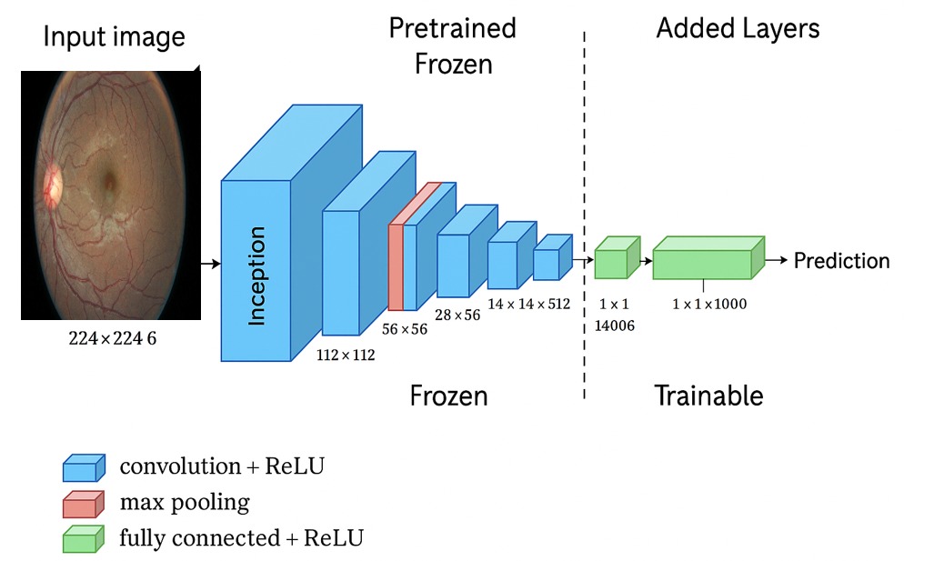 Comparación del rendimiento de redes neuronales convolucionales para la clasificación automática de la retinopatía diabética (DR).