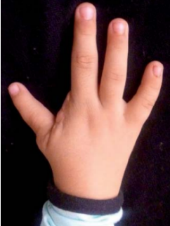 Ejercitador de dedo pulgarizado