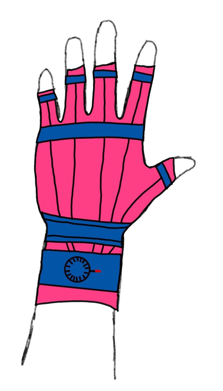 Ortesis de miembro superior derecho para paciente con ACV