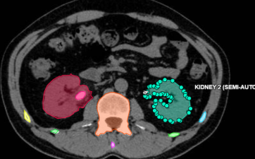 Sistema de Cribado Automatizado para Estudios de Imagen Radiológica mediante Machine Learning.