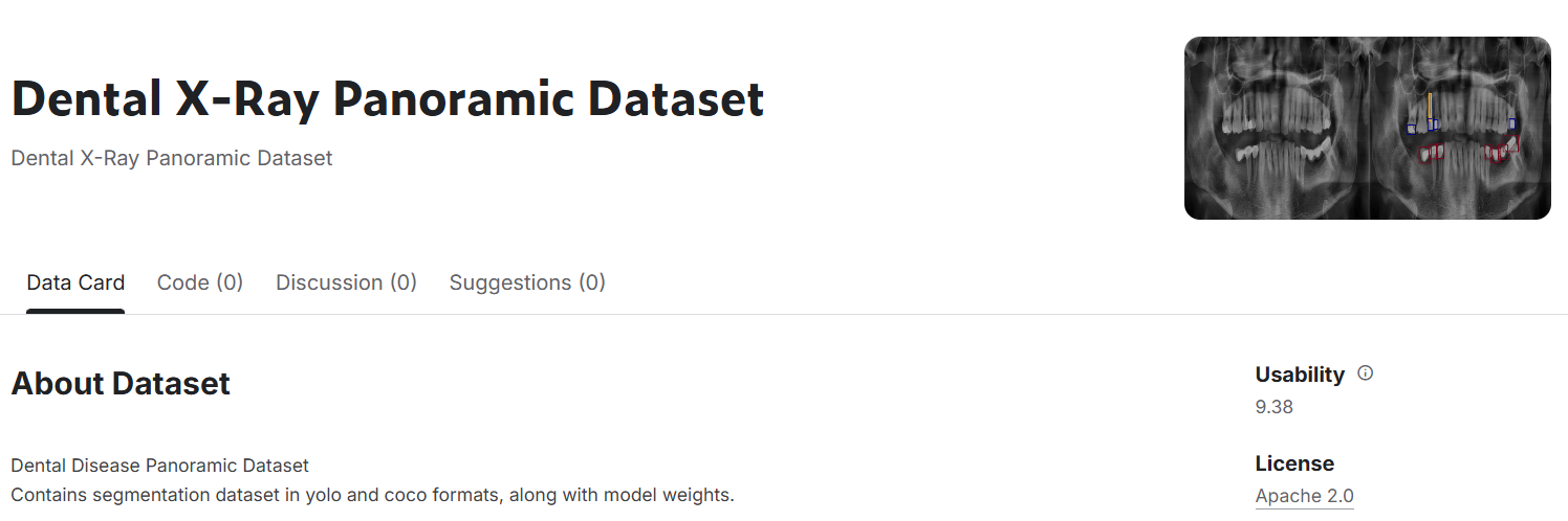 Clasificación automatizada de enfermedades orales en radiografías dentales utilizando modelos de Redes Neuronales Convolucionales preentrenados.