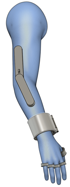 Órtesis de Miembro Superior